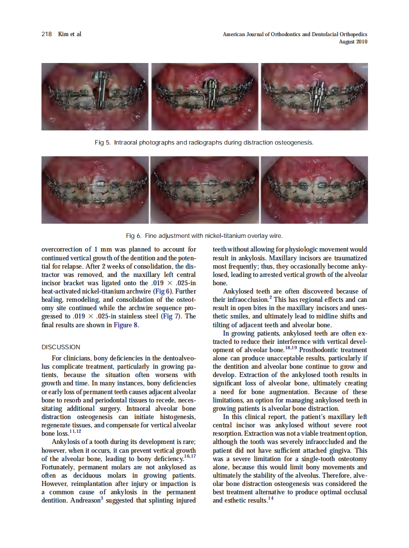 2010_138_2_215_220.pdf 第4页