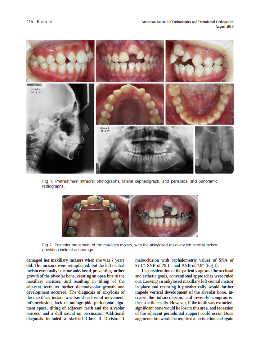 2010_138_2_215_220.pdf 第2页
