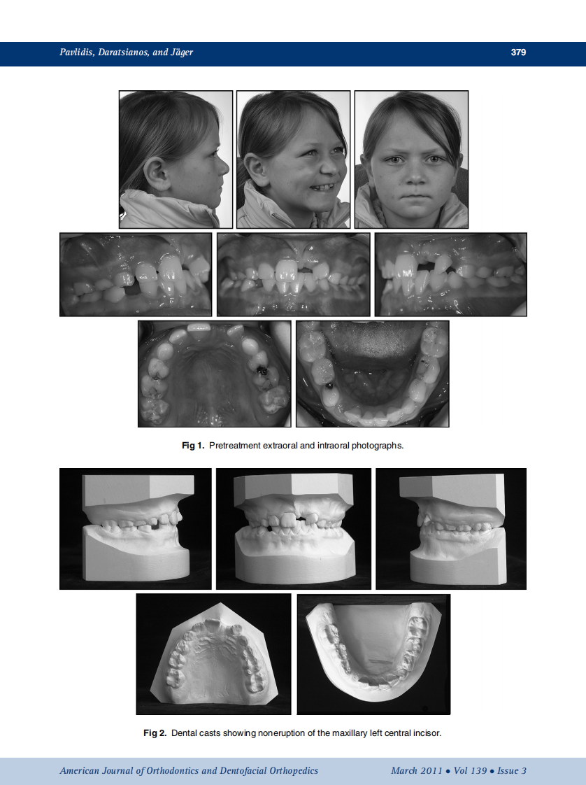 2011_139_3_378_387.pdf 第2页