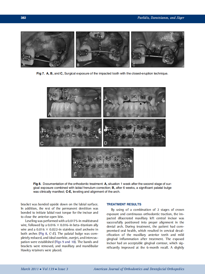 2011_139_3_378_387.pdf 第5页