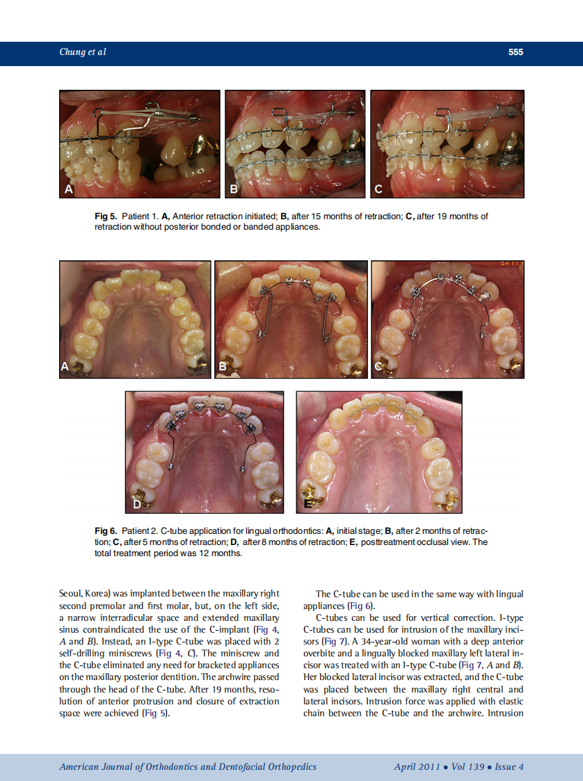 2011_139_4_551_562.pdf 第5页