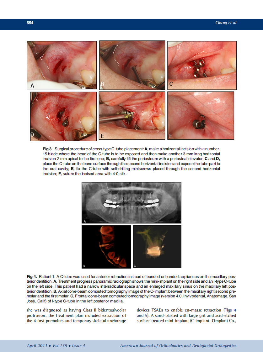 2011_139_4_551_562.pdf 第4页