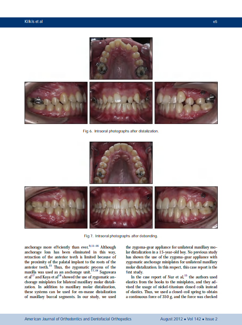1-s2.0-S0889540612004428-main.pdf 第5页