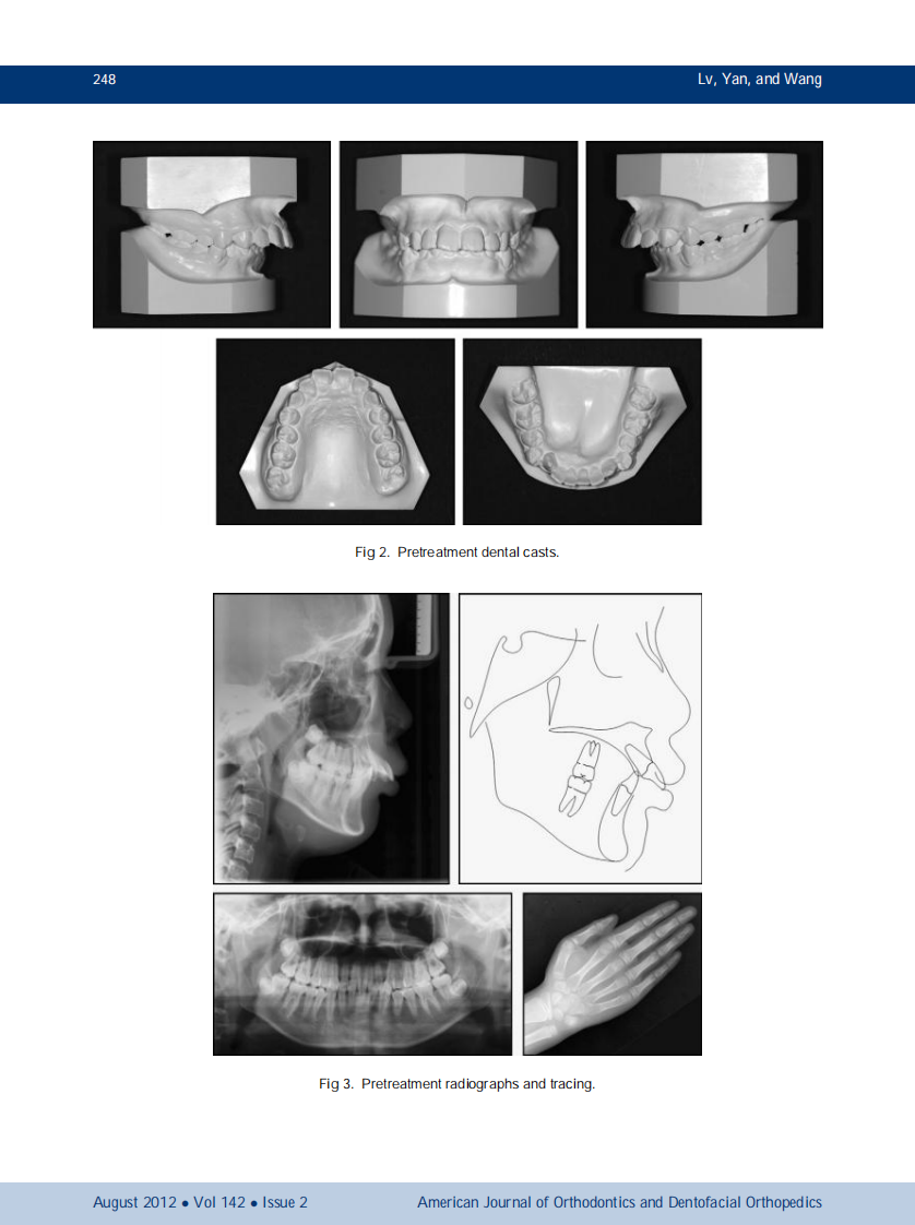 1-s2.0-S0889540612004490-main.pdf 第3页