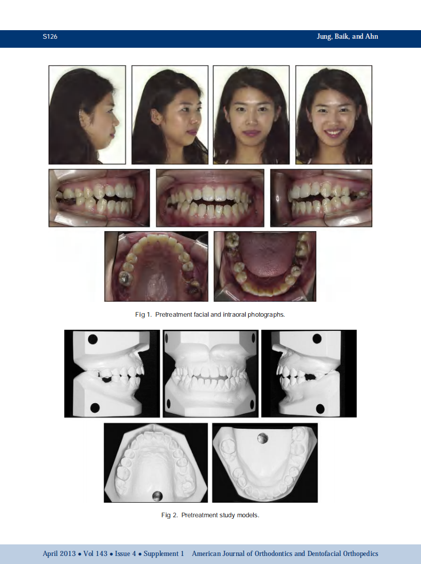1-s2.0-S0889540612008700-main.pdf 第2页