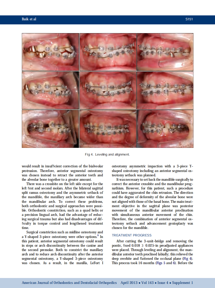 1-s2.0-S0889540612009006-main.pdf 第4页