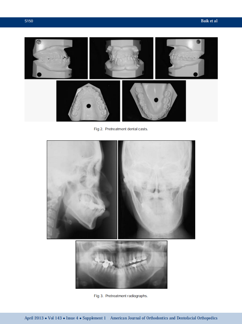 1-s2.0-S0889540612009006-main.pdf 第3页