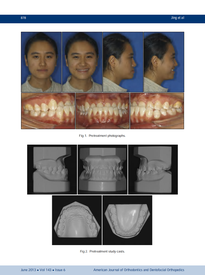 1-s2.0-S0889540613001650-main.pdf 第2页