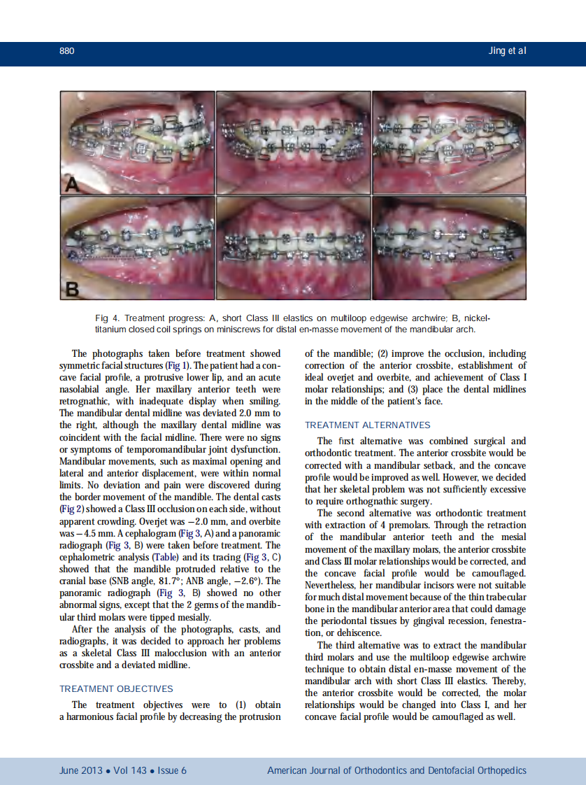1-s2.0-S0889540613001650-main.pdf 第4页