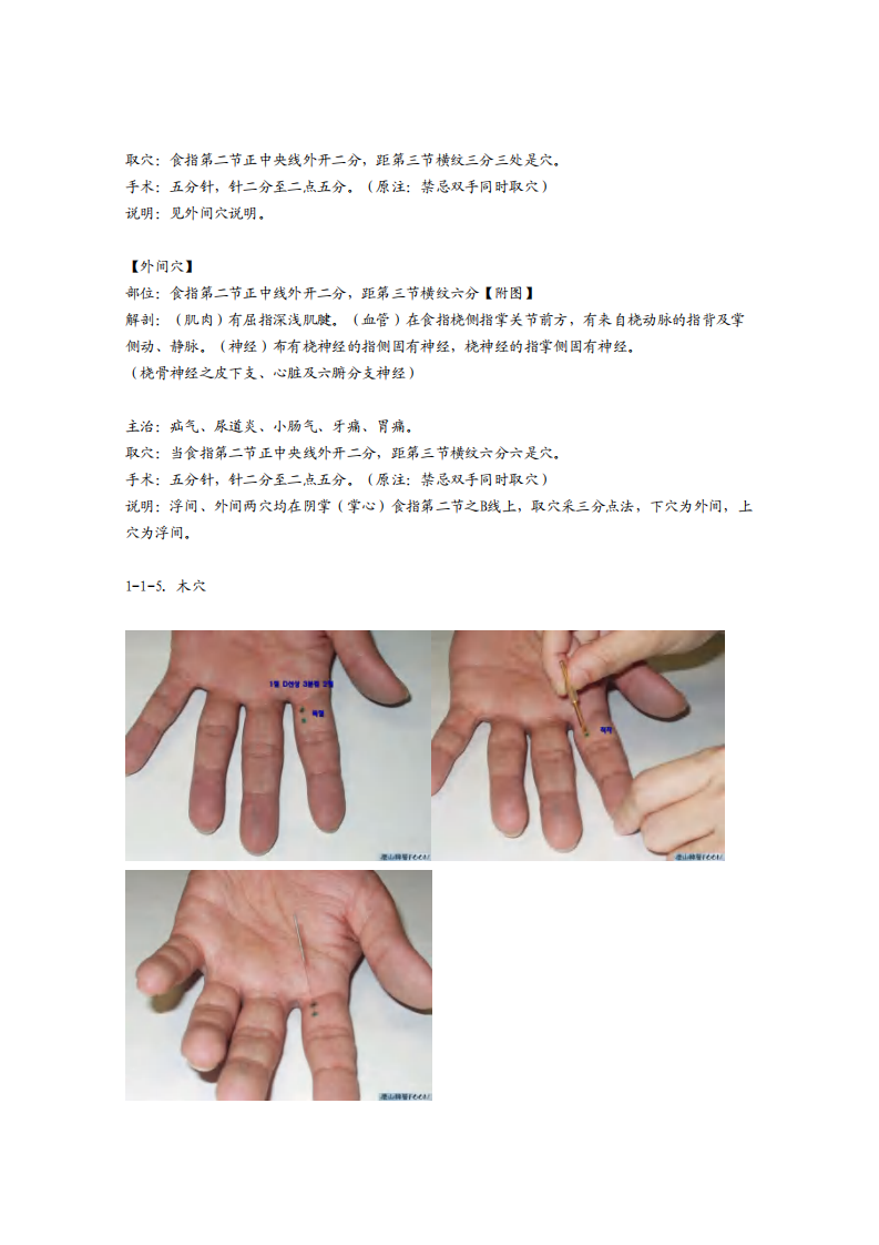 董氏奇穴发挥整理1-1.pdf 第5页