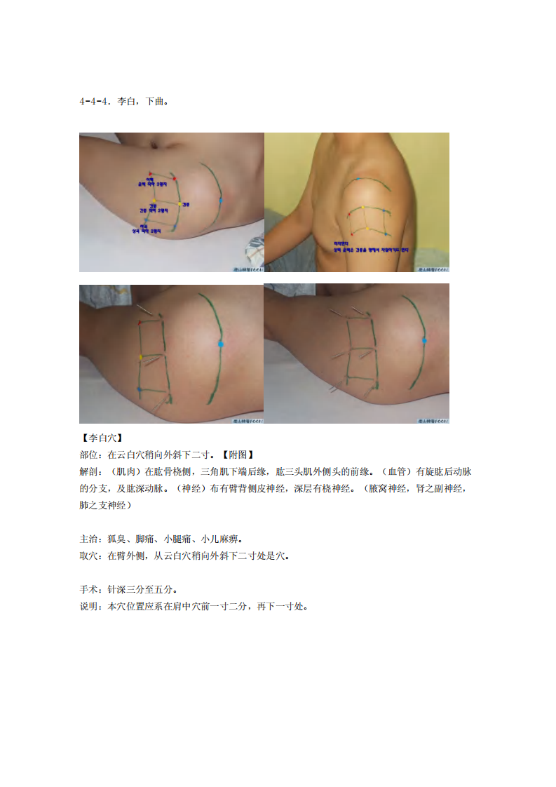 董氏奇穴发挥整理4-4.pdf 第4页