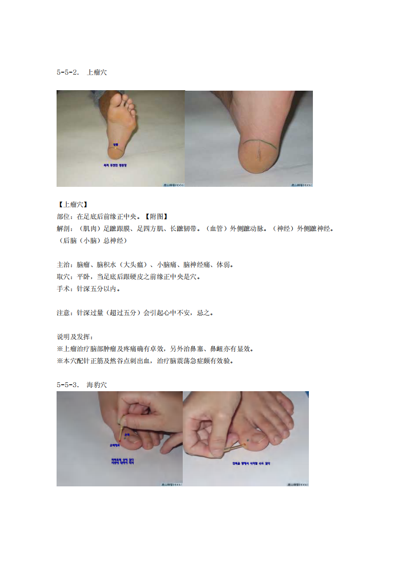 董氏奇穴发挥整理5-5.pdf 第2页