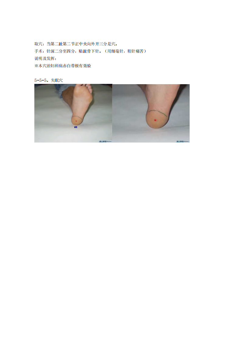 董氏奇穴发挥整理5-5.pdf 第4页