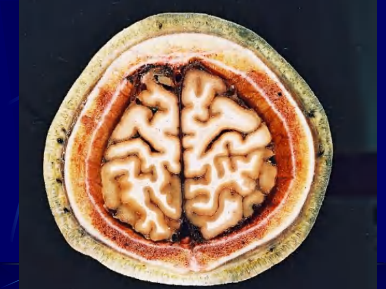 02 头部连续横断层解剖及CT、MRI.pdf 第5页