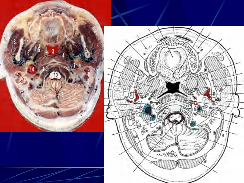 06 颈部连续横断层解剖.pdf 第5页