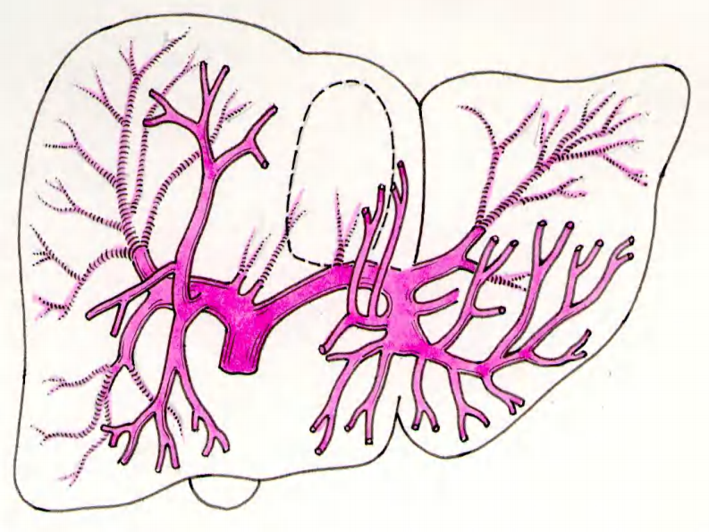 09 肝内管道和肝段断层解剖.pdf 第5页