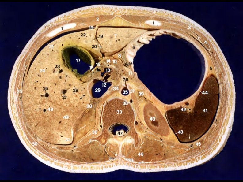 10 胰和肝外胆道断层解剖及CT.pdf 第5页