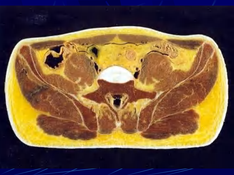 11 男性盆部和会阴断层解剖.pdf 第2页