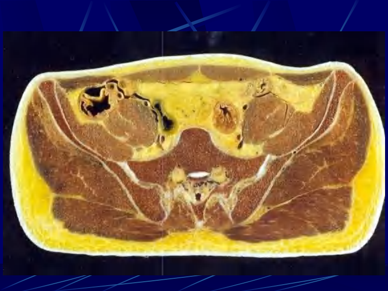 11 男性盆部和会阴断层解剖.pdf 第3页