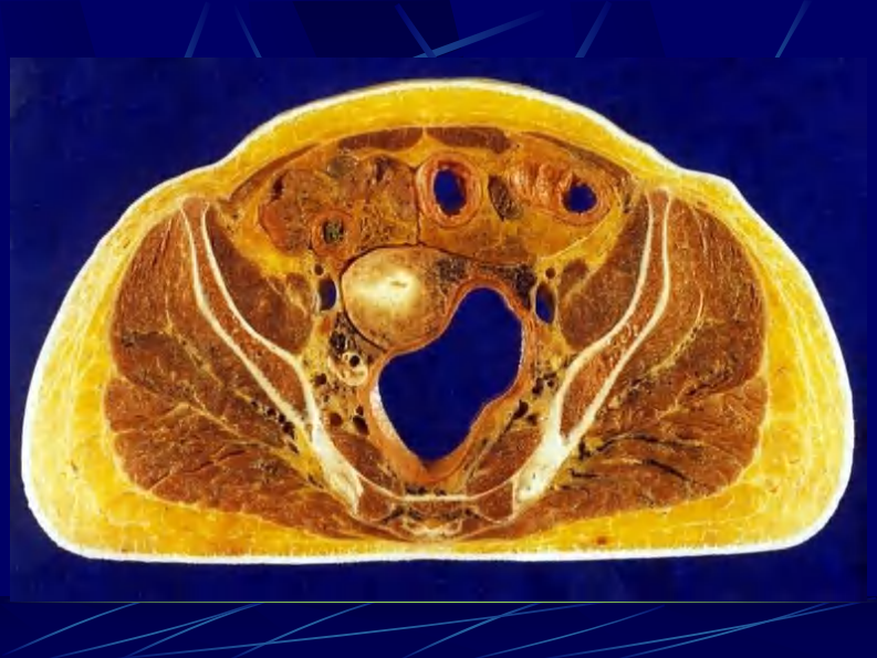12 女性盆部和会阴断层解剖.pdf 第5页