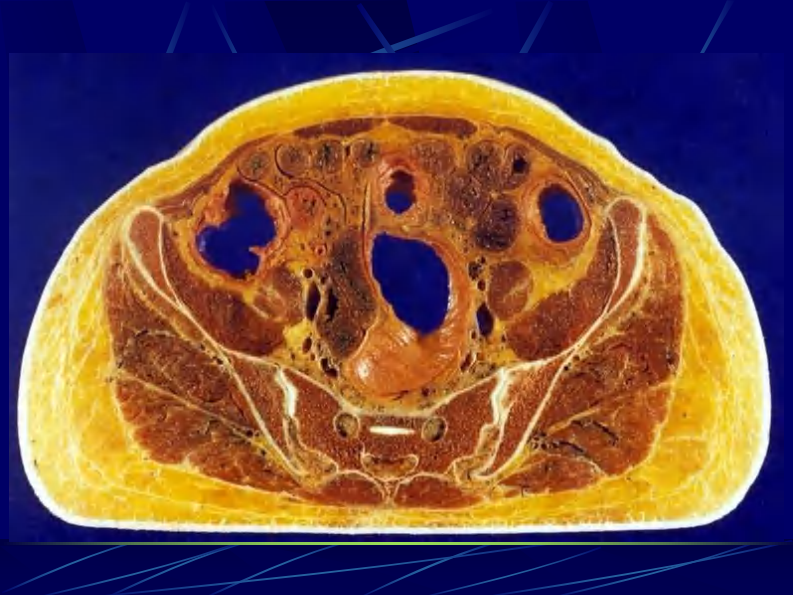 12 女性盆部和会阴断层解剖.pdf 第3页