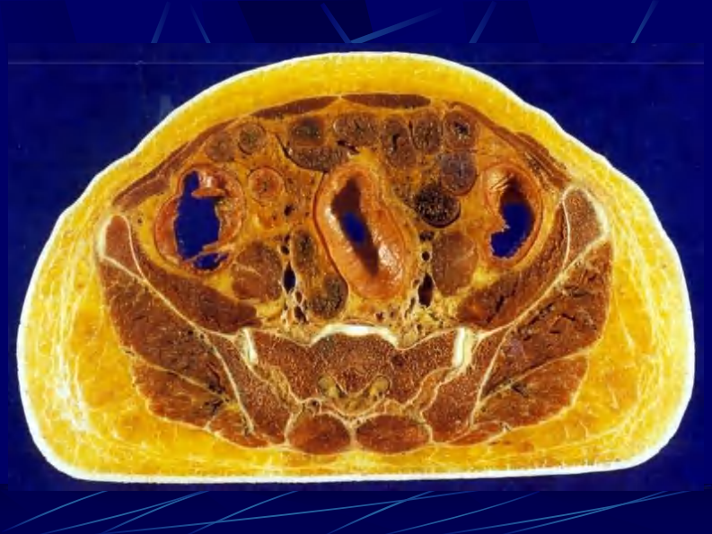 12 女性盆部和会阴断层解剖.pdf 第2页