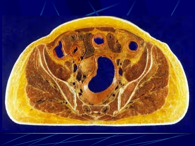 12 女性盆部和会阴断层解剖.pdf 第4页