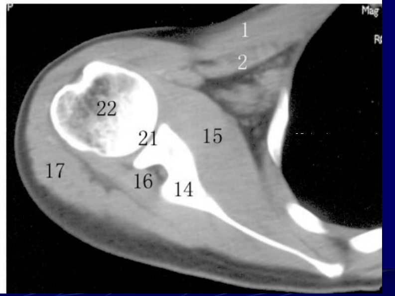 14 四肢断层解剖及CT、MRI.pdf 第4页