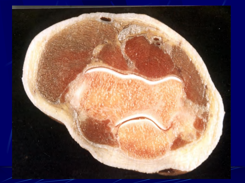 14 四肢断层解剖及CT、MRI.pdf 第5页