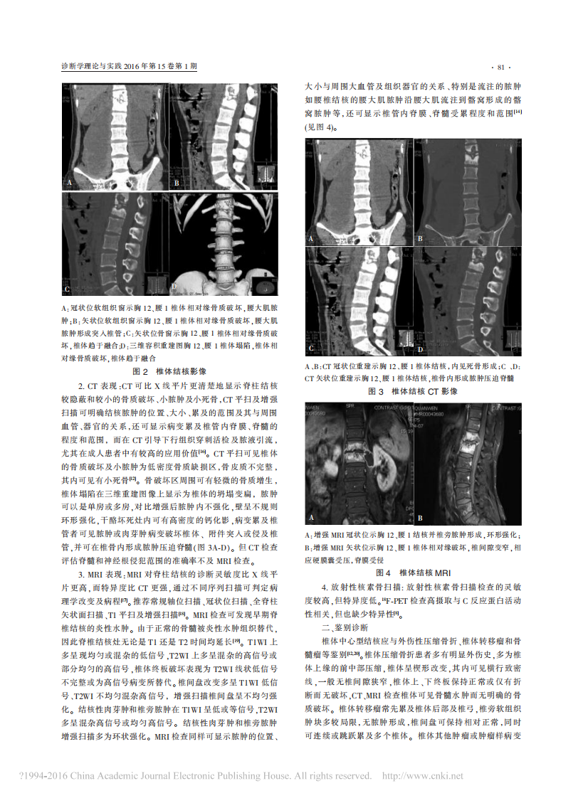 骨关节结核影像学诊断的现状及展望_侯代伦.pdf 第2页
