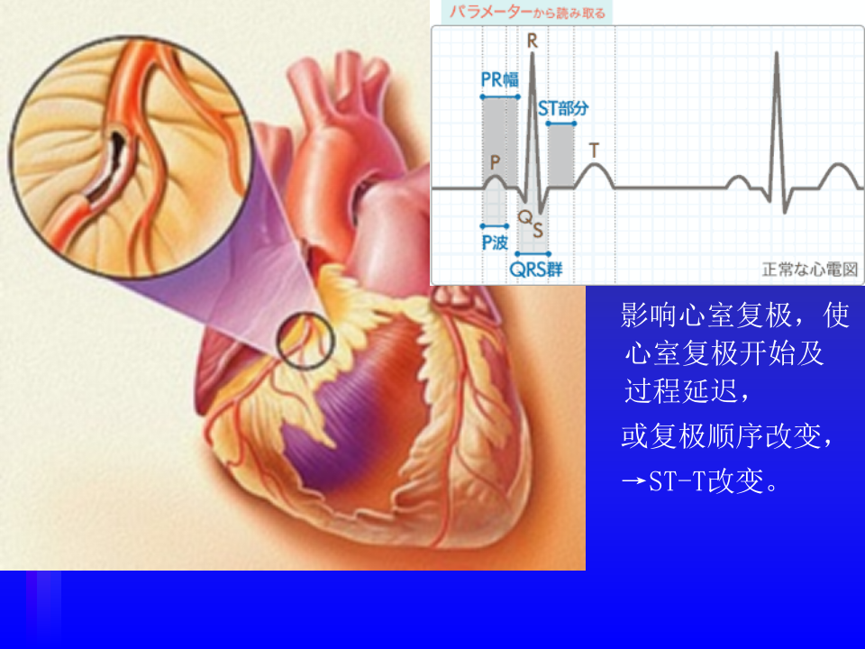 心电图－第三次课（4、5节）.ppt 第2页