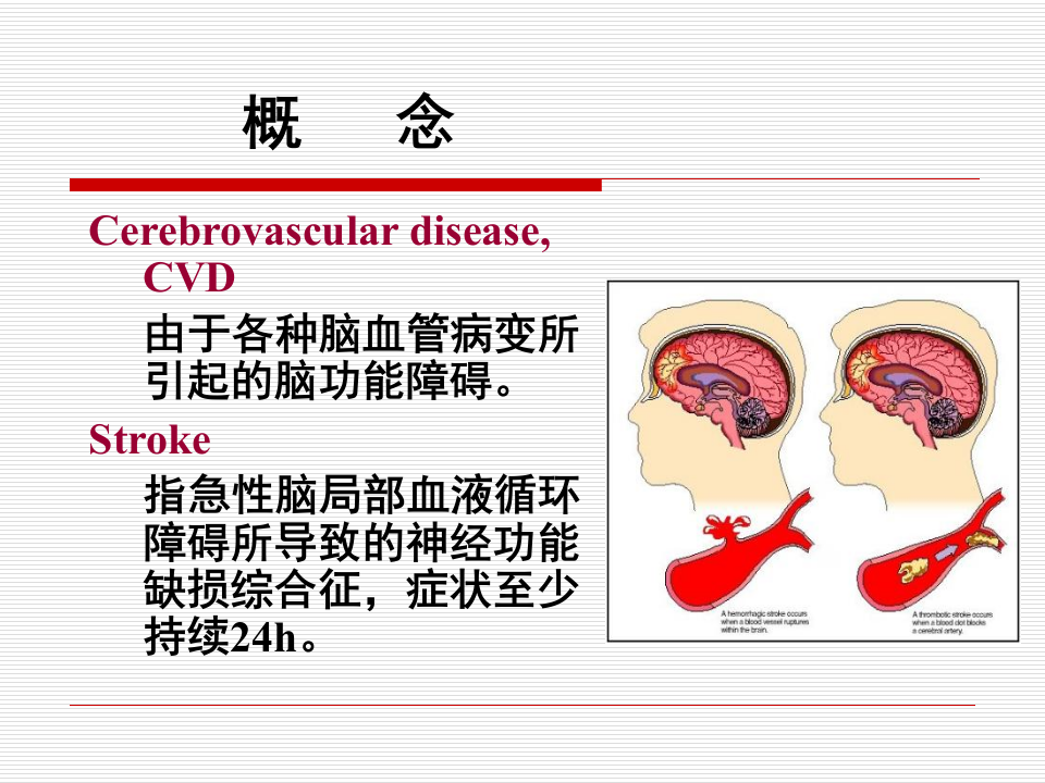 20150325春季2012级放射口腔缺血性cvd.ppt 第4页