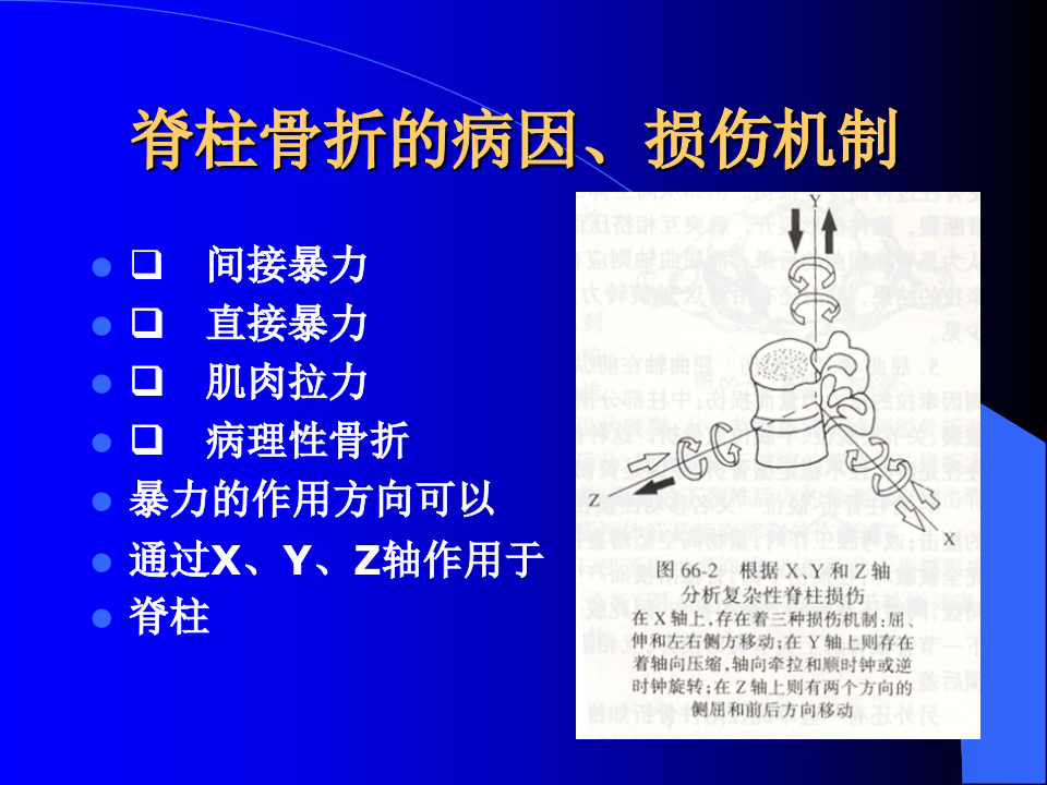 脊柱骨折-中日联谊医院.ppt 第3页