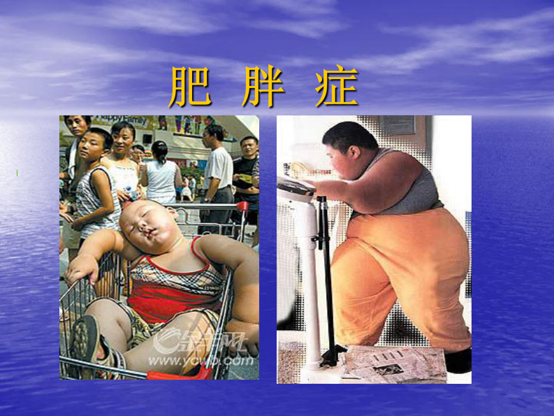 61内分泌科-肥胖症及其预防PPT讲解.pdf 第1页