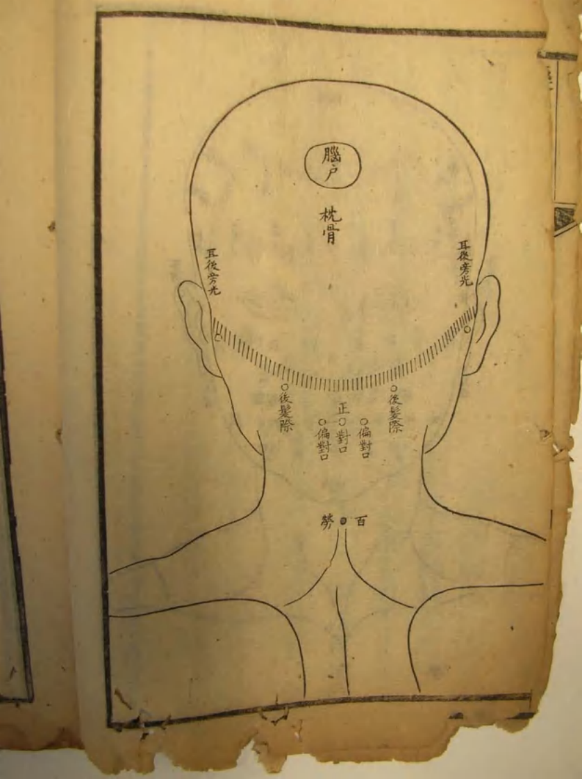 刺疔捷法pdf（另一个版本，相机版）.pdf 第5页