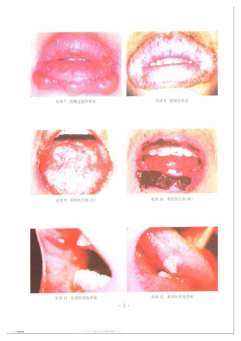 口腔粘膜病学第2版.pdf 第5页
