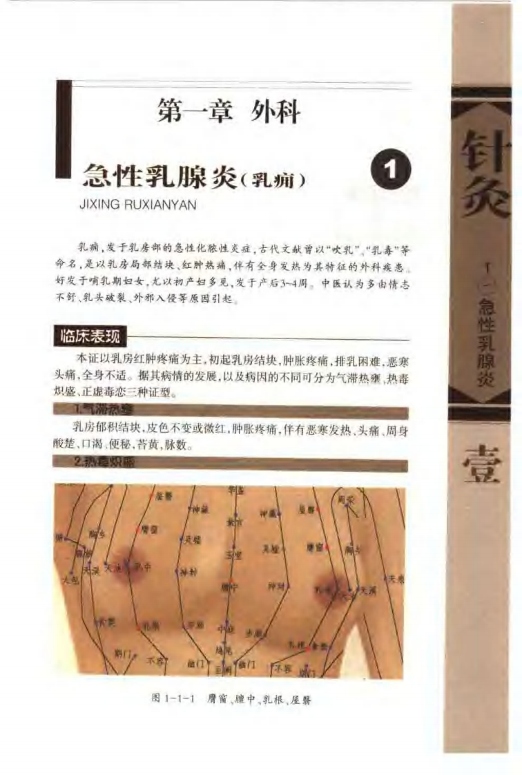 针灸治疗常见病证图解 外科、皮肤科分册（张建华）.pdf 第4页