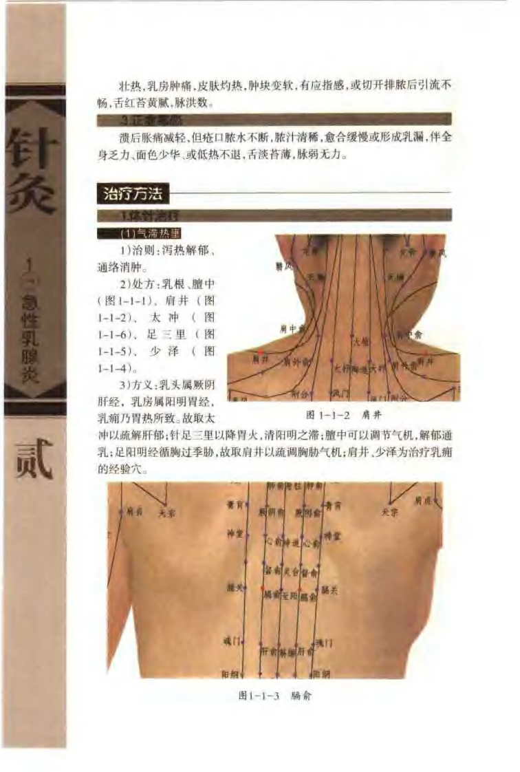 针灸治疗常见病证图解 外科、皮肤科分册（张建华）.pdf 第5页