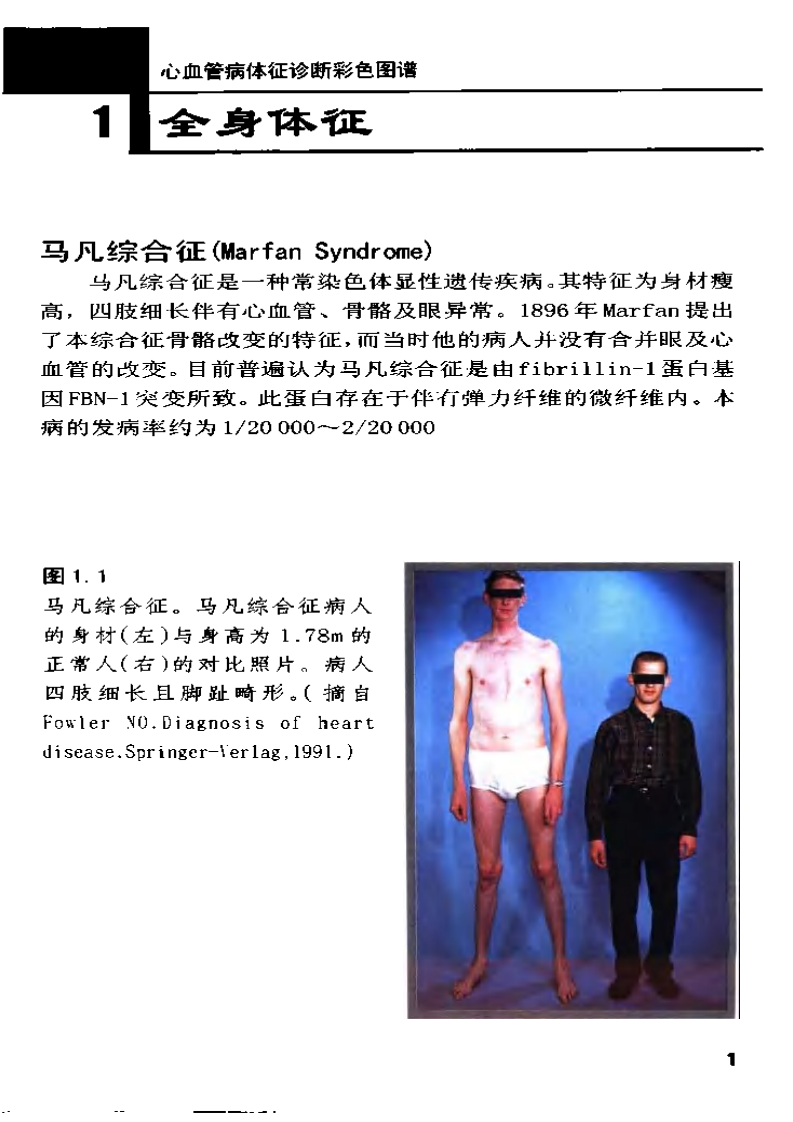 心血管病体征诊断彩色图谱（中文扫描版）.pdf 第3页