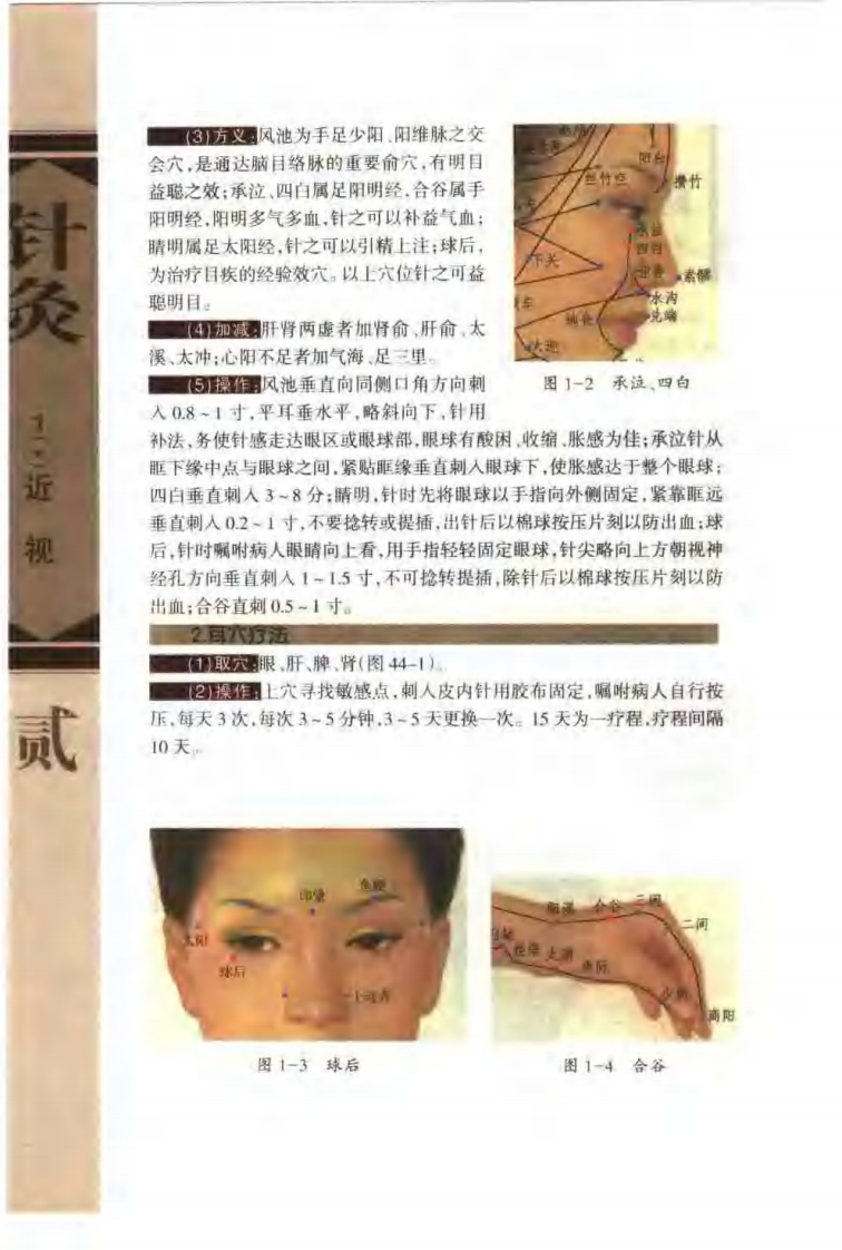 针灸治疗常见病证图解 五官科分册（张建华）.pdf 第5页