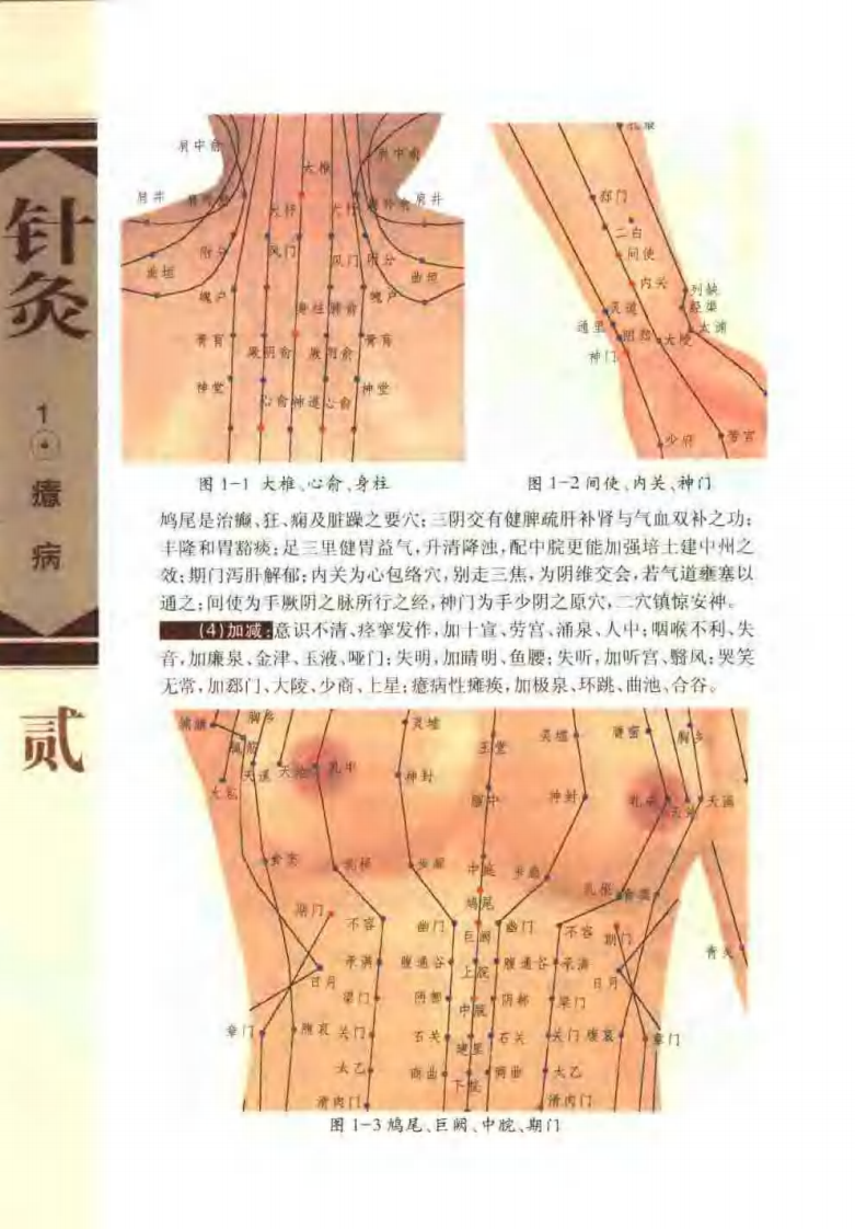 针灸治疗常见病证图解 神经、精神科分册（张建华）.pdf 第5页