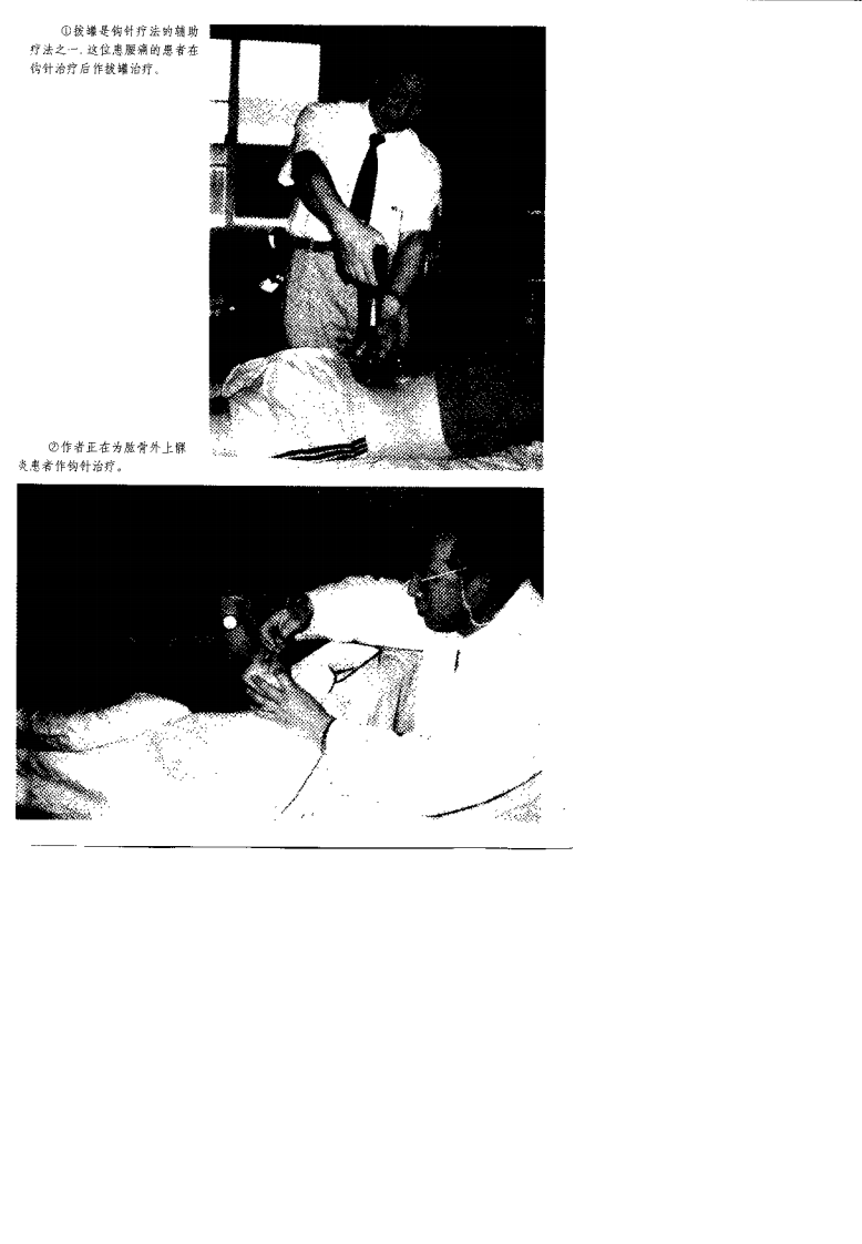 中国钩针疗法（杨楣良）.pdf 第2页