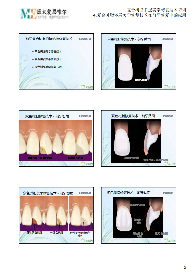 4.复合树脂多层美学修复技术在前牙修复中的应用.PDF 第3页