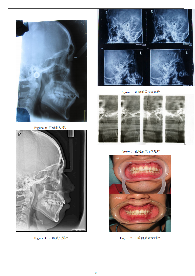 矫正牙齿后遗症.pdf 第2页