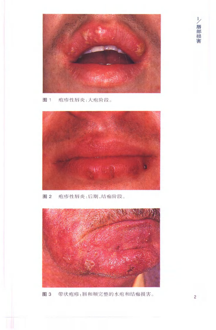 袖诊疗彩色图谱系列 口腔疾病[英]斯卡利（Scully，C.）编著.pdf 第4页