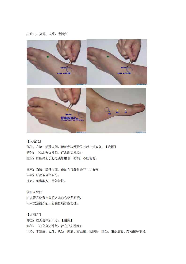 童氏奇穴发挥整理6-6.pdf 第1页