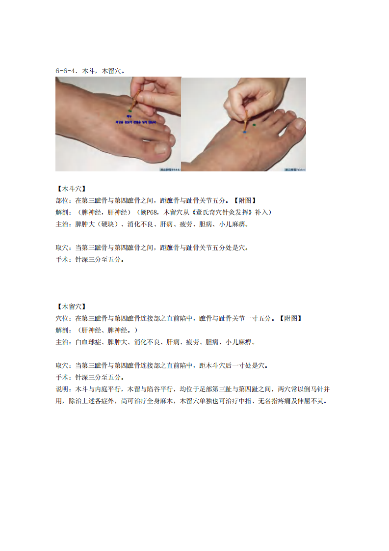 童氏奇穴发挥整理6-6.pdf 第5页