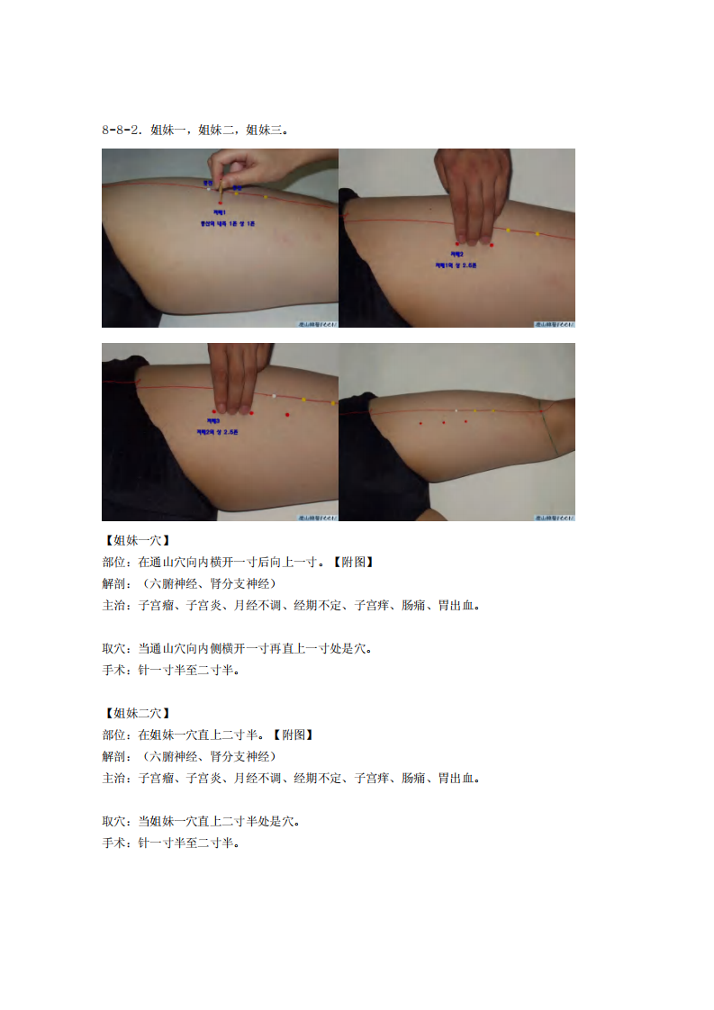 童氏奇穴发挥整理8-8.pdf 第3页