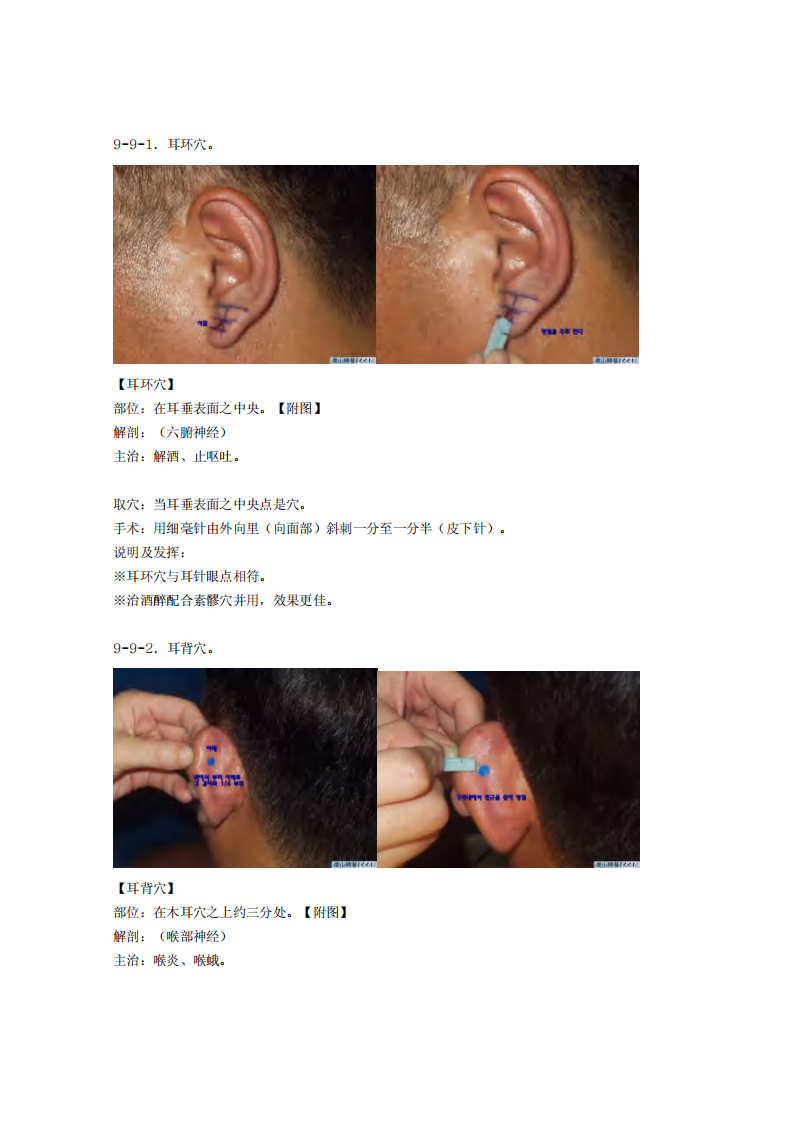 童氏奇穴发挥整理9-9.pdf 第1页