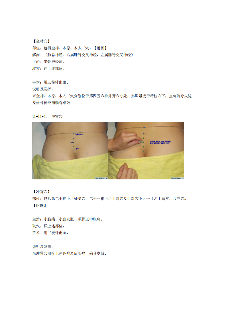 童氏奇穴发挥整理11-11.pdf 第3页